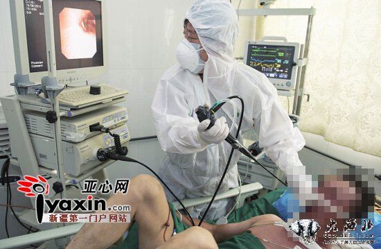 乌鲁木齐市一名H7N9病人转危为安